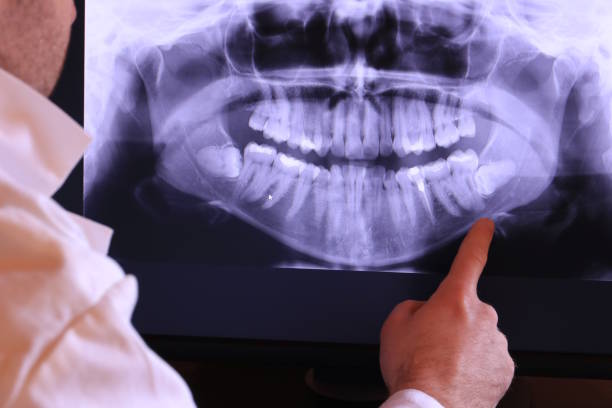 Best Root Canal Emergency Dentist  in Gra Forks Af, ND