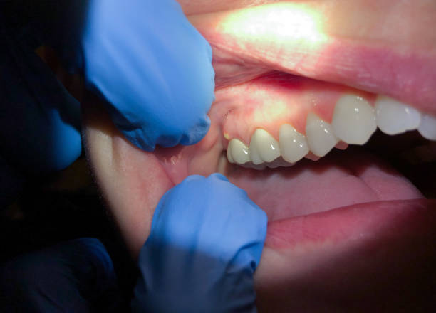 Best Knocked-Out Tooth Emergency  in Gra Forks Af, ND